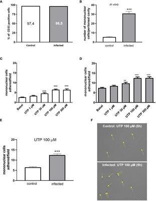 P2Y2-P2X7 receptors cross-talk in primed mesenteric endothelial cells upregulates NF-κB signaling favoring mononuclear cell adhesion in schistosomiasis